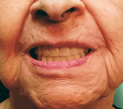 Slider image (6) Smiletec® - Leading Mexicali Dental Clinic